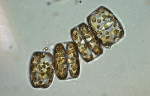 diatom_750_382155_382256